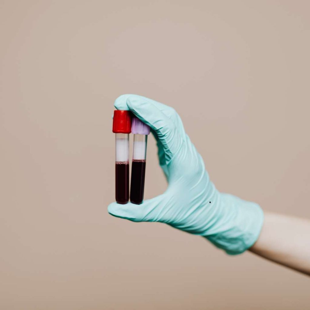 Exame de sangue para detectar câncer Conheça todos os tipos 1